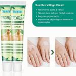 Sumifun Vitiligo Treatment Cream White Spot